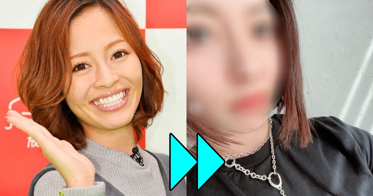 小森純、整形告白!「産後絶対やりたかった」顔にメス入れ、大満足!「ほうれい線が消えた」「目もイジりましたね」