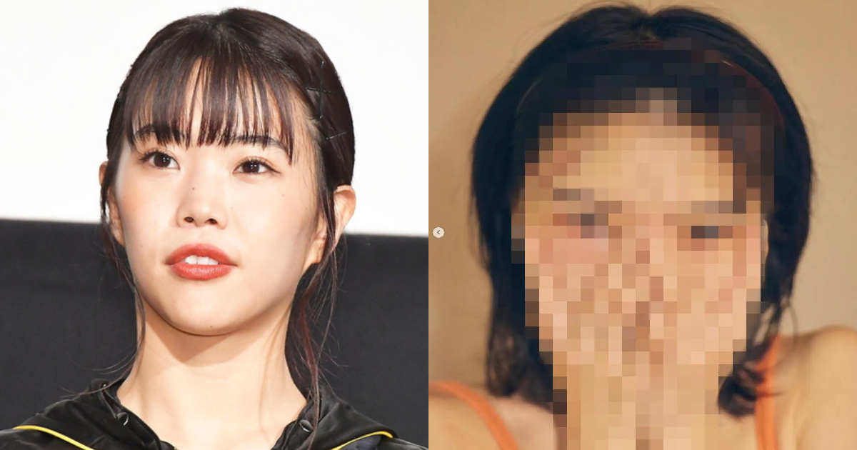 e696b0e8a68fe38397e383ade382b8e382a7e382afe38388 90.png - 「BiSH」アイナ・ジ・エンド、額を30針縫うケガを見せつけ波紋「思ってたより酷くてグロい」「生きててよかった…」