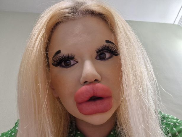 Exclusive Woman With Worlds Biggest Lips Says She Cannot Find Love Despite Millions Of Fans 