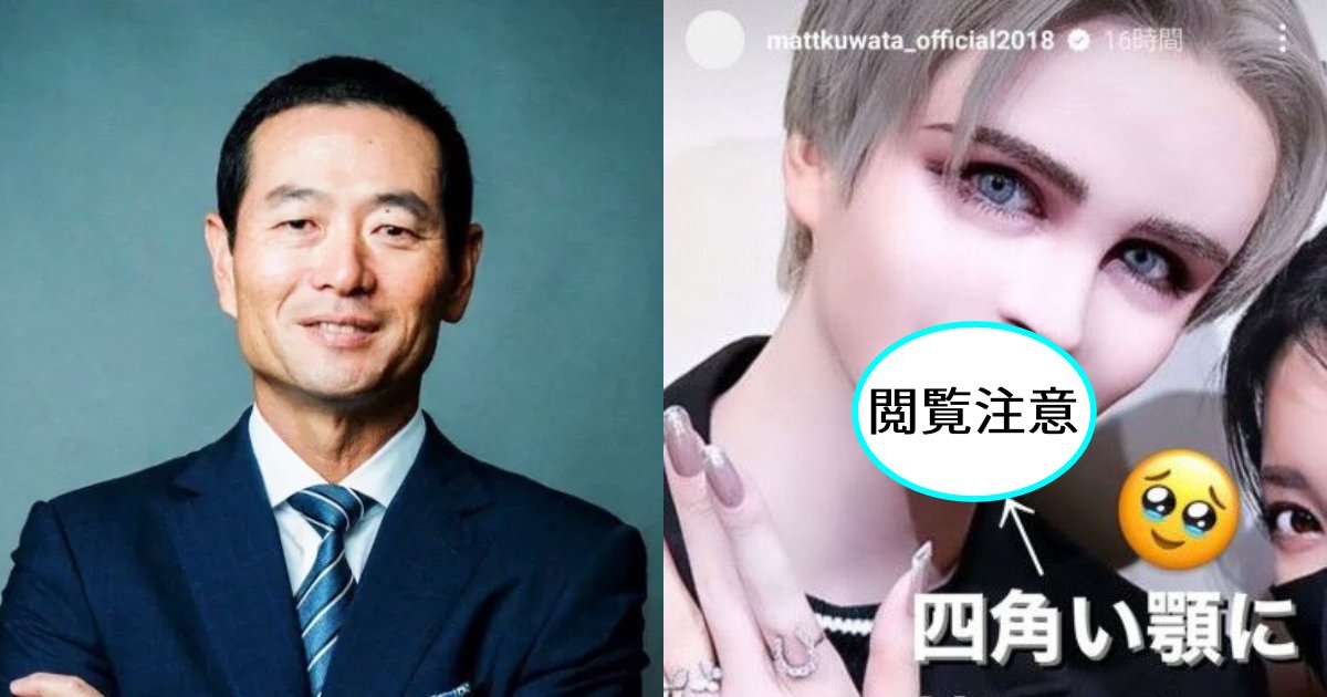 桑田真澄の次男Matt、整形したアゴに異変!突然、腫れ上がってしまう…「余計なもの注入するから」「自業自得ですね」