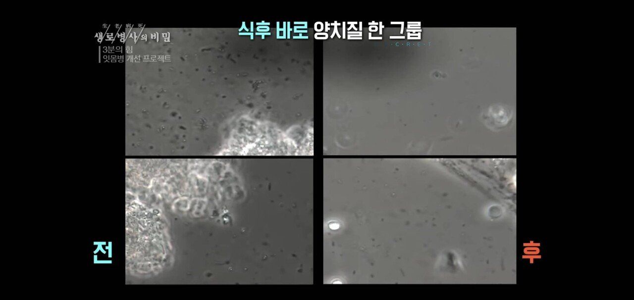 779A563F-9C66-4DB1-A390-87F6A24EFFF9.jpeg 자기 직전에 양치질하는 사람들 충격적 실험 결과.jpg