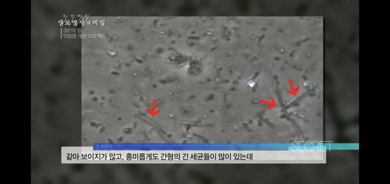 F8290FF9-B24F-4764-9F8E-BCD50FB6ACF1.jpeg 자기 직전에 양치질하는 사람들 충격적 실험 결과.jpg