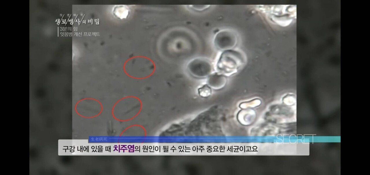 518D6A70-9DA0-482A-9175-EC0771650639.jpeg 자기 직전에 양치질하는 사람들 충격적 실험 결과.jpg