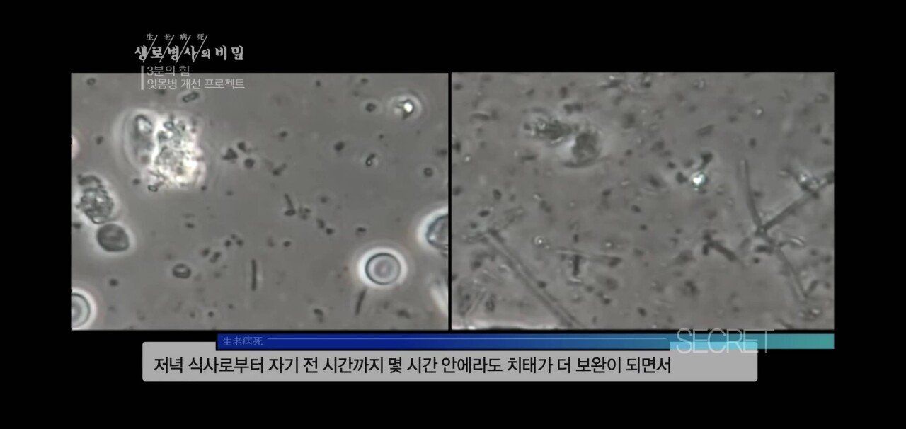 A9C6EA1F-BCE3-4A9F-BCBB-AD3216CADFCB.jpeg 자기 직전에 양치질하는 사람들 충격적 실험 결과.jpg