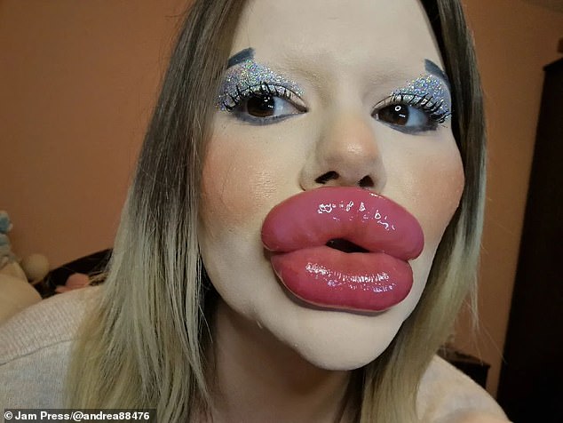 Woman Who Spent Thousands To Get World’s Biggest Lips Is Now Spending ...