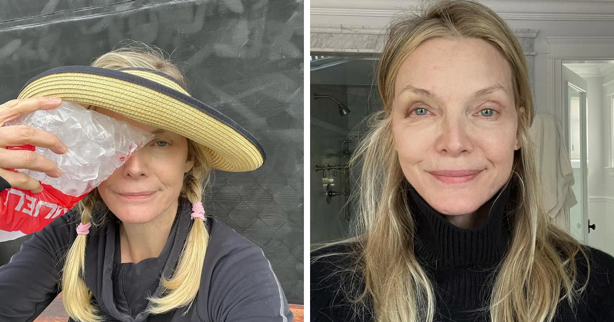 d159 1.jpg - BREAKING: Fans Devastated As Actress Michelle Pfeiffer Smiles Through The Pain After Showing Off Fresh BLACK EYE