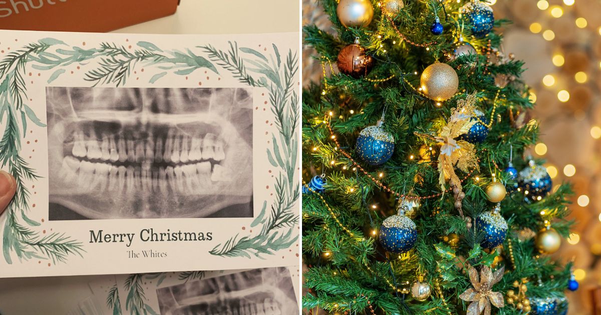 teeth6.jpg - Man Accidentally Prints Dental X-Ray On His Family Christmas Cards And It's Not Even His But Belongs To His Neighbor