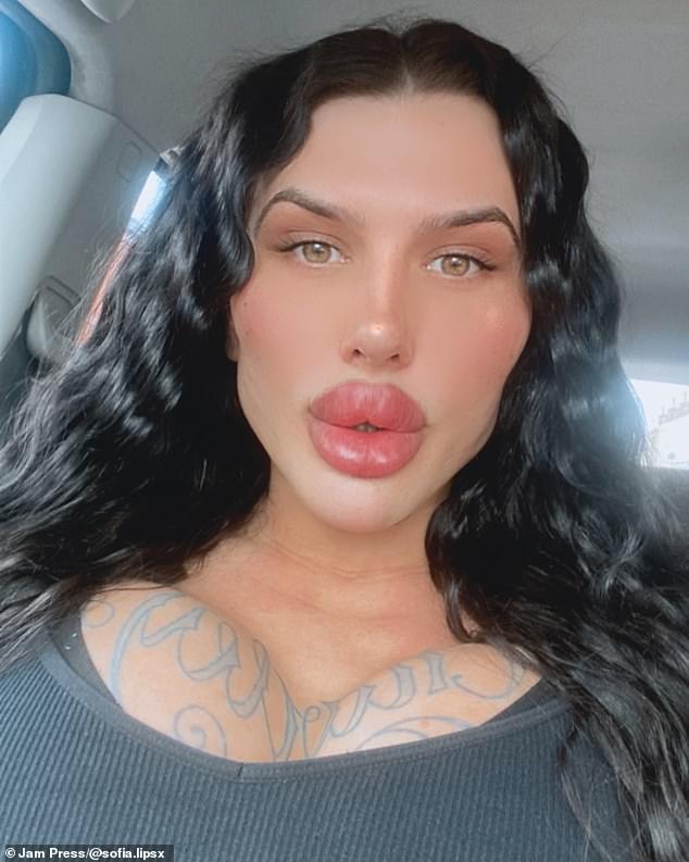 Woman With World's Biggest Lips Undergoes SIX Plastic Surgeries In One ...