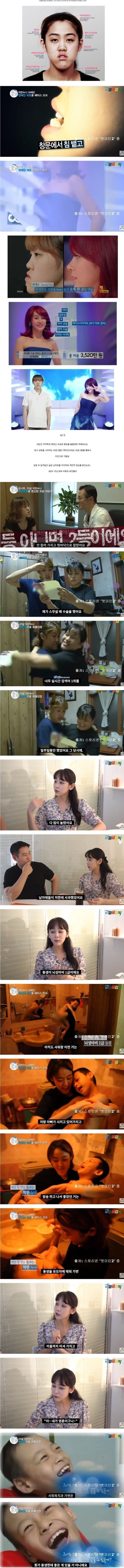 20240223084308_DhOJe57ZNe.jpeg 렛미인 주걱턱녀 8년후 현재 근황 .jpg