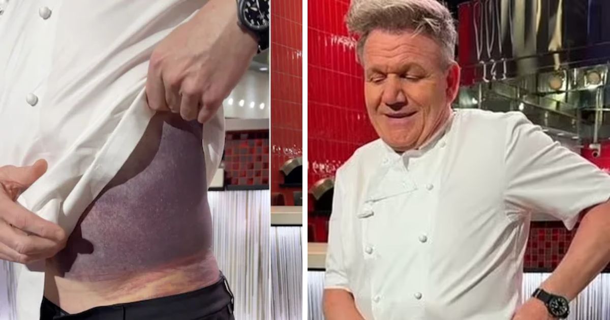 copy of articles thumbnail 1200 x 630 6 9.jpg - Chef Gordon Ramsey Suffers Horrific Injuries In 'Near Death' Cycling Accident