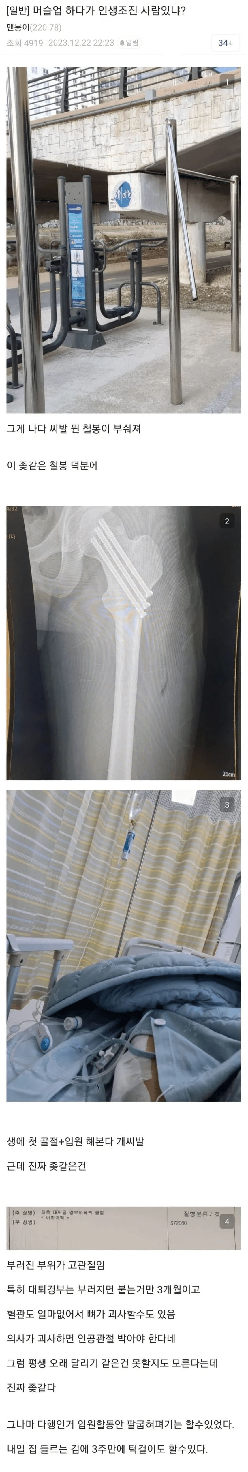 image.png 철봉 하다가 인생 꼬인 사람 jpg