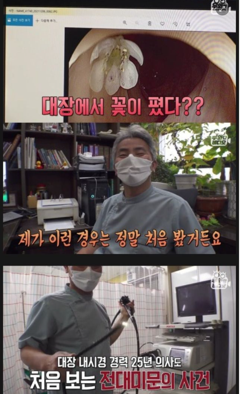 9 7.png - 대장내시경 중 몸 안에서 발견된 것