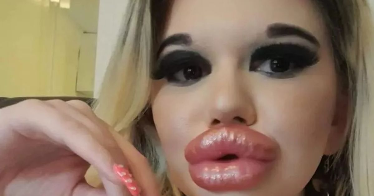 copy of articles thumbnail 1200 x 630 10 16.jpg - Woman With World’s Biggest Lips Says Finding A Man Has Become IMPOSSIBLE For Her