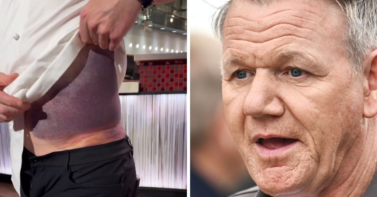 copy of articles thumbnail 1200 x 630 10 6.jpg - Gordon Ramsay Shows Off Horrific Bruise on Torso and Fans are Stunned After Finding Out What Caused It