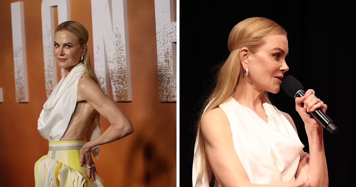 copy of articles thumbnail 1200 x 630 11 13.jpg - "Please Eat!"- Fans Express Concerns For Nicole Kidman After Star Looks 'Thinner Than Ever' As She's Seen Tearing Up On Red Carpet