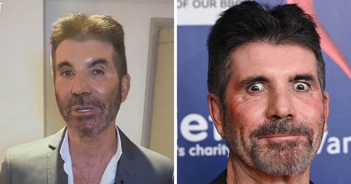 copy of articles thumbnail 1200 x 630 2 14.jpg - What's Wrong With His Face? Fans React As Simon Cowell's Ever Changing Face Leaves Many Stunned