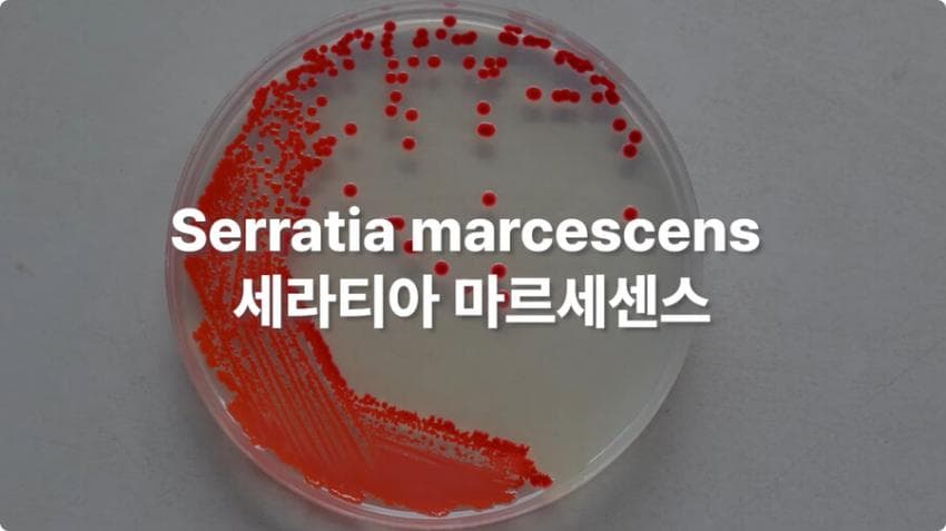 스압) 화장실 청소를 열심히 해야하는 이유