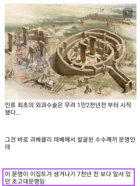 8 36.png - 믿을 수가 없는 '1만 2천년전 뇌수술'