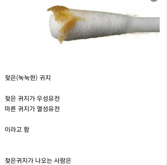 9 32.png - 한국사람은 드물다는 귀지 타입