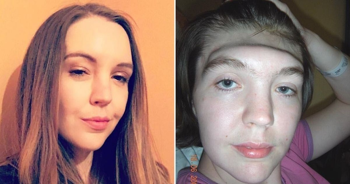 copy of articles thumbnail 1200 x 630 2 31.jpg - Woman Who Lost Her Entire Forehead Due To A Simple Error Is Warning Others Not To Repeat Her Mistake