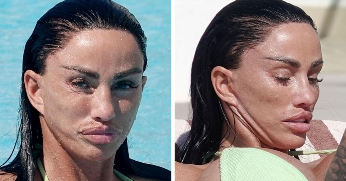 copy of articles thumbnail 1200 x 630 5 2.jpg - Katie Price Looks UNRECOGNIZABLE After Getting More Cosmetic Work Done Weeks After Major Facelift