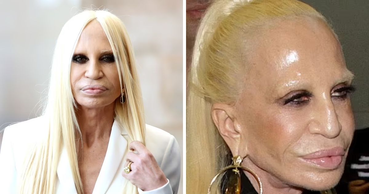 copy of articles thumbnail 1200 x 630 5 7.jpg - What Has Donatella Versace Done To Her Face Now? Fans STUNNED At Her Wild Transformation