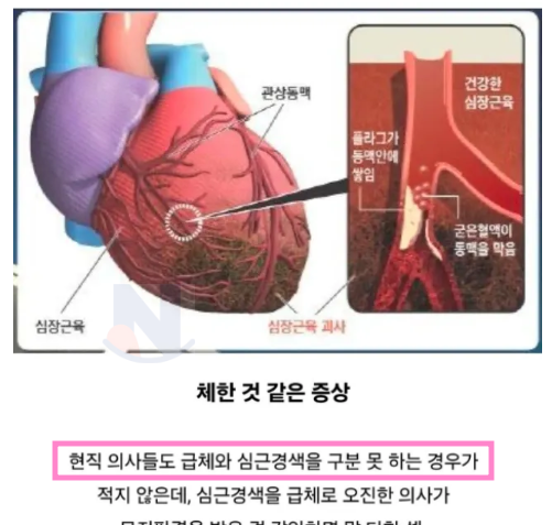 6 44.png - 경력직의사도 오진한다는 심근경색의 대표적인 전조증상...