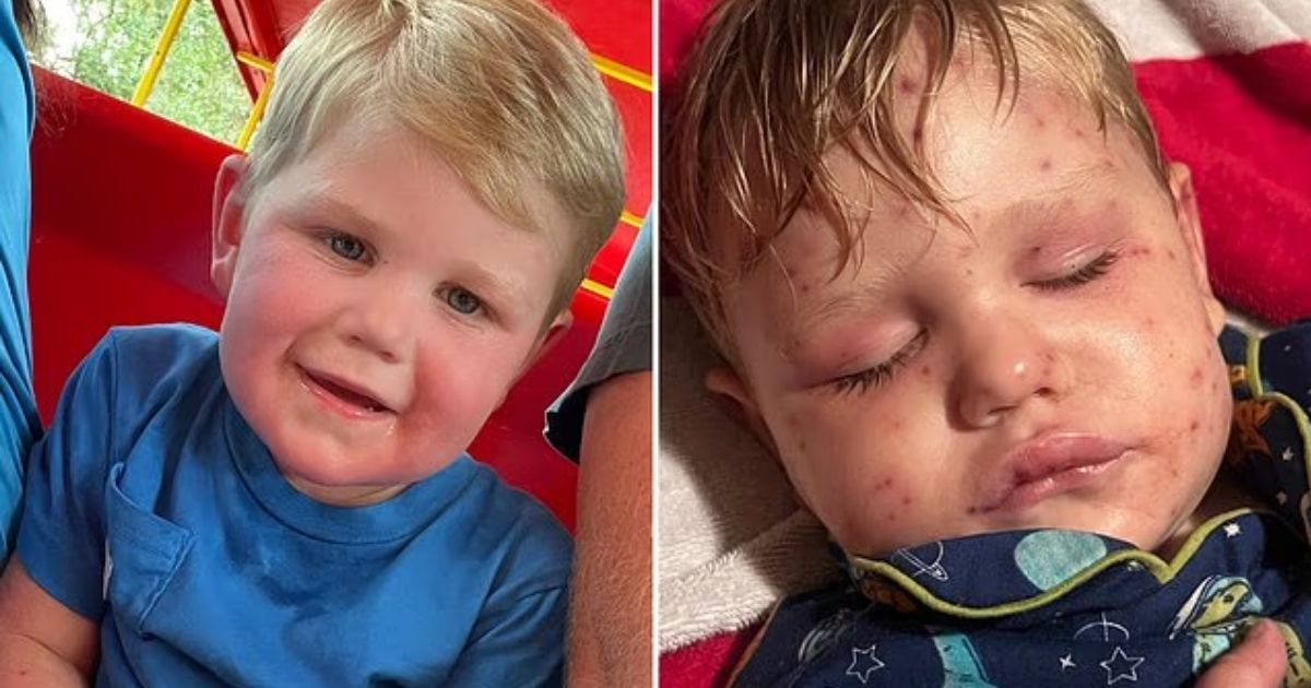 copy of articles thumbnail 1200 x 630 95 6.jpg - Georgia Toddler With Missing Kidney Left On Life Support After Being Stung Over 150 Times by Wasps