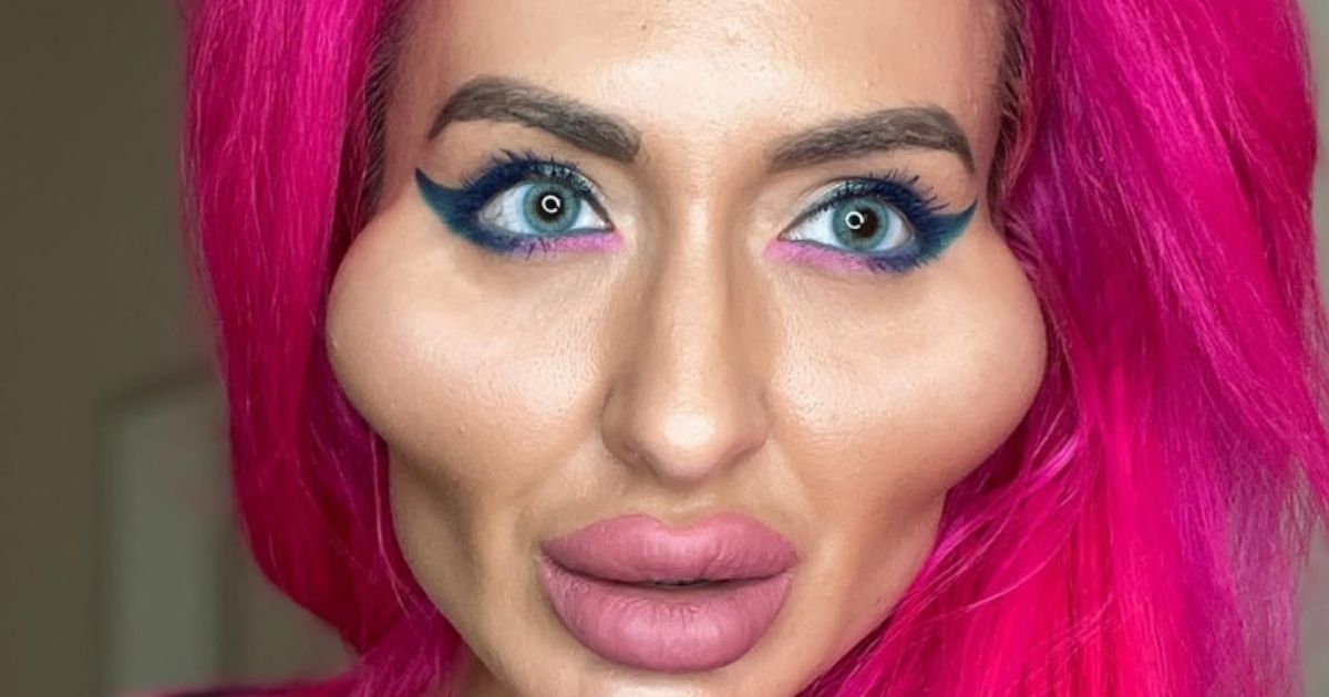 copy of articles thumbnail 1200 x 630 2025 07 29t140558 507.jpg - Woman with 'world's biggest cheeks' hits back at trolls who mock her looks