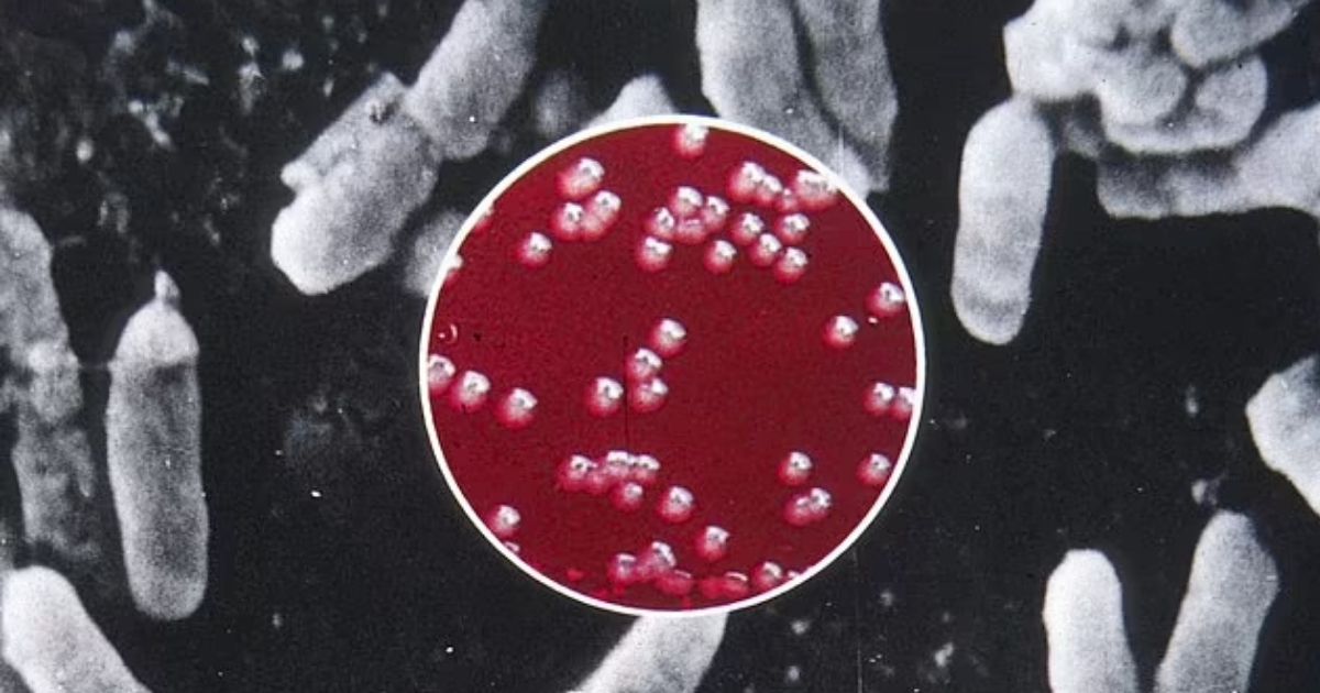 copy of articles thumbnail 1200 x 630 2025 08 25t160234 493.jpg - Man DIES from the PLAGUE in America's first fatal case in years - experts explain why the region is a hotspot