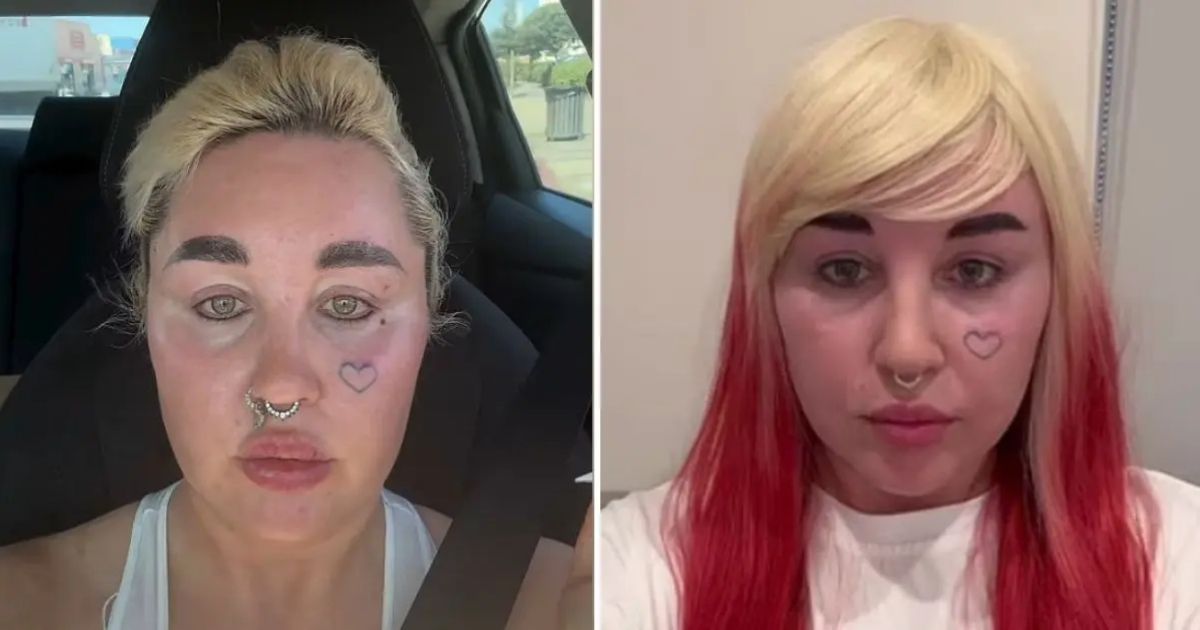 copy of articles thumbnail 1200 x 630 2025 08 26t135510 862.jpg - Amanda Bynes shows off stunning new look after undergoing cosmetic procedure while battling her mental health