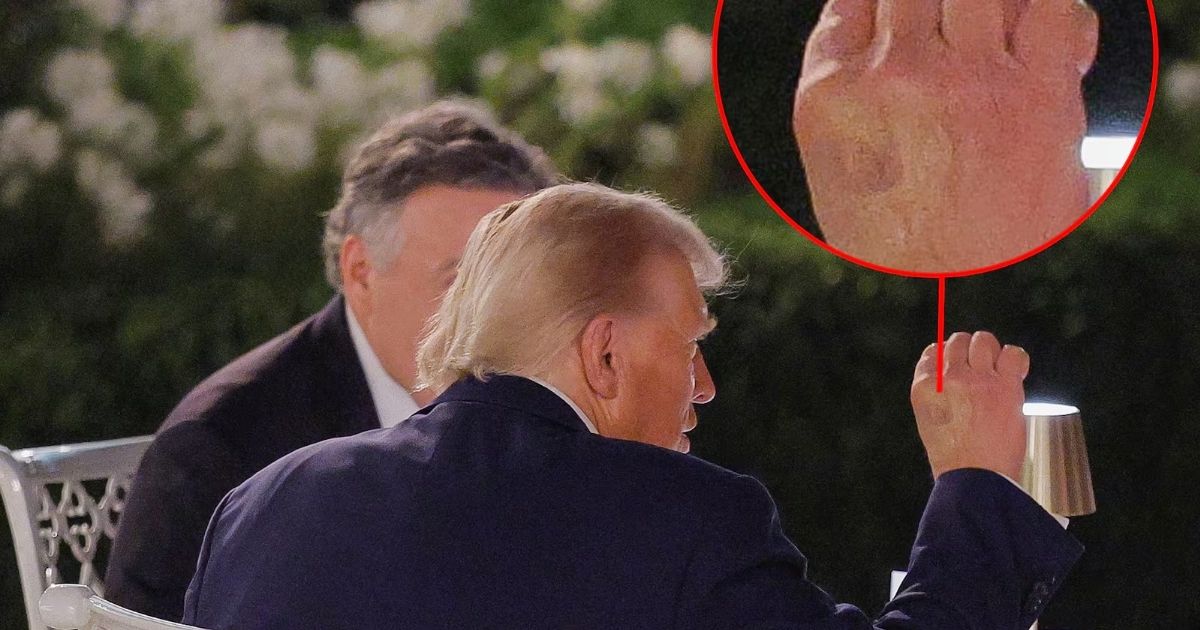 copy of articles thumbnail 1200 x 630 2025 09 06t222536 284.jpg - Trump’s Makeup-Slathered Hand Pops Up at Rose Garden Dinner As President Tries His Best to Hide Hands Under the Table