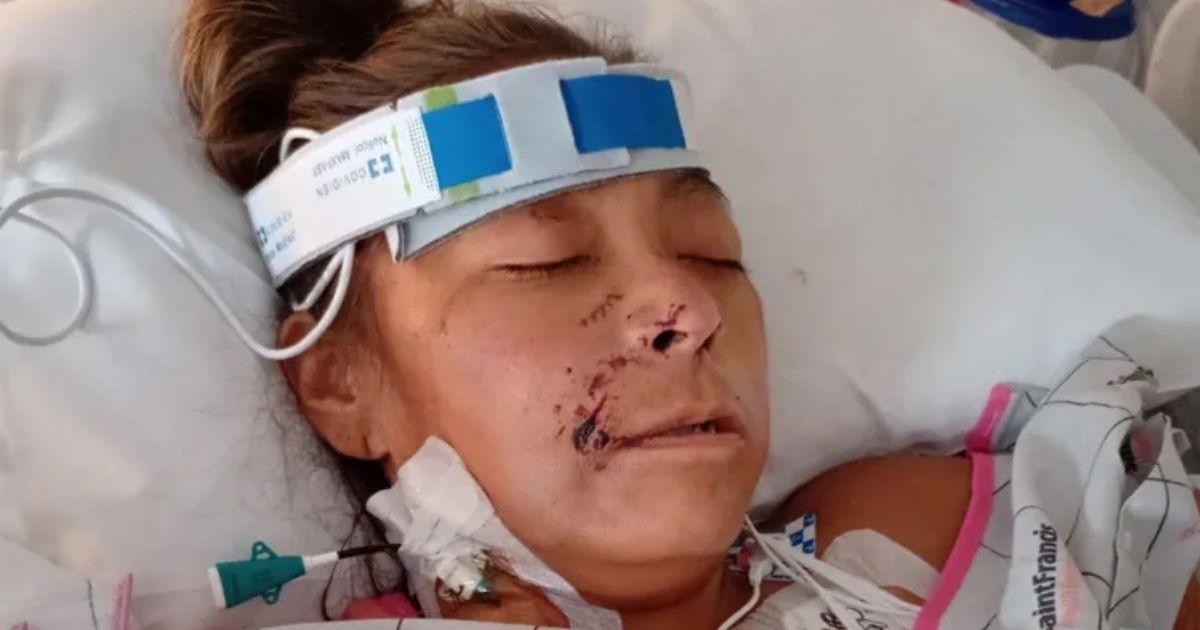 copy of articles thumbnail 1200 x 630 2025 09 25t213430 219.jpg - Oklahoma Woman Attacked by Pair of Dogs While Riding Bike Loses All 4 Limbs
