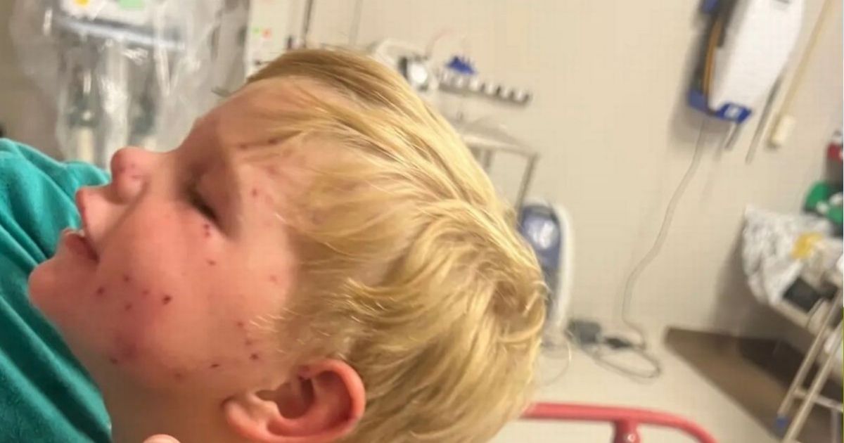 copy of articles thumbnail 1200 x 630 2025 10 20t143044 804.jpg - Horror as 2-year-old boy's organs shut down after being stung 150 times by wasps
