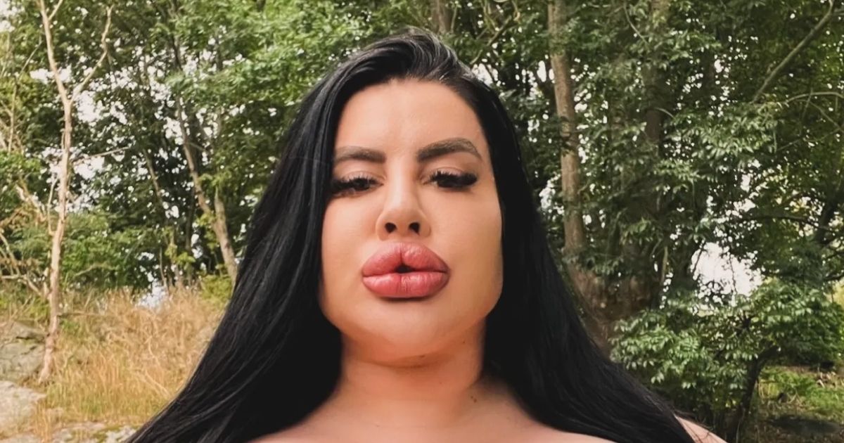 copy of articles thumbnail 1200 x 630 97 12.jpg - Woman Spends $150,000 on FIVE Brazilian Butt Lifts - Now Her 'Before' Photos Leave Internet SHOCKED